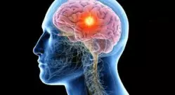 cerveau